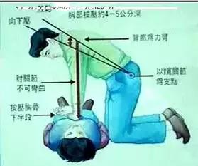 2015年国际新标准心肺复苏术操作指南,流程 2015年国际新标准心肺复苏术操作指南,流程